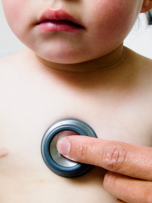 Breastfeeding and CMPA
